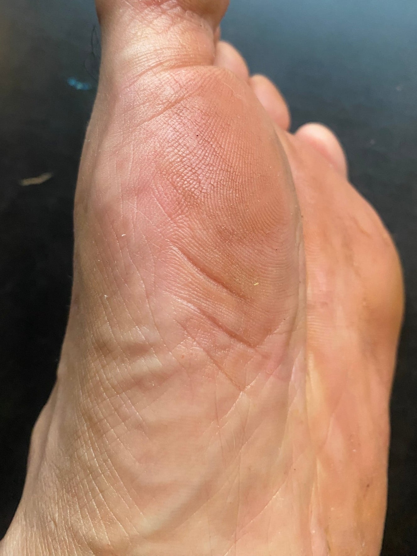 After image